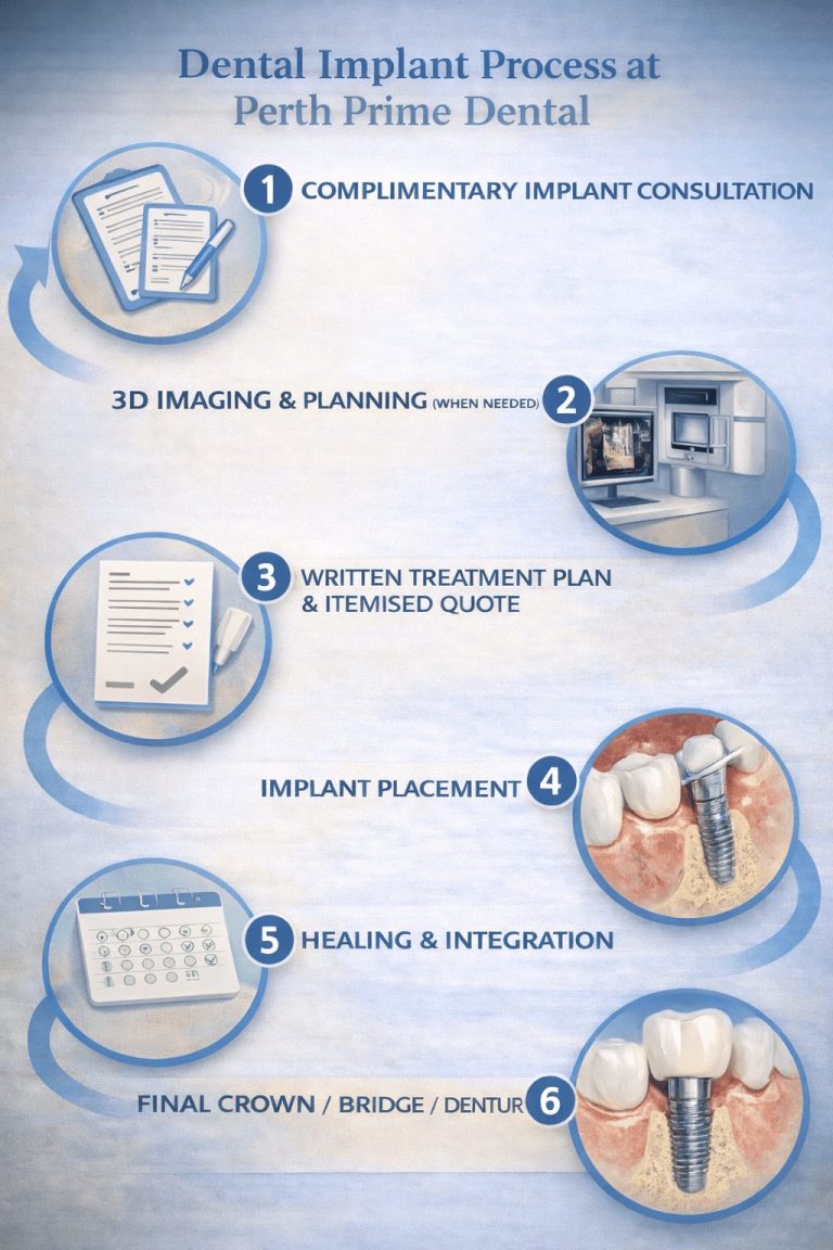 Dental implant treatment timeline Perth