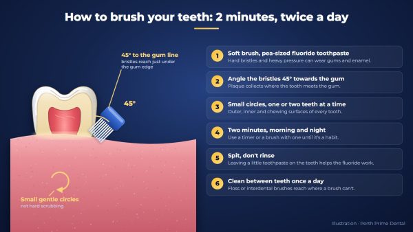 How to brush your teeth: toothbrush bristles angled at 45 degrees to the gum line, with six steps from soft brush and fluoride toothpaste to cleaning between teeth